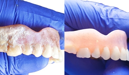 SYMPRO Cleaning system for removable dental restorations